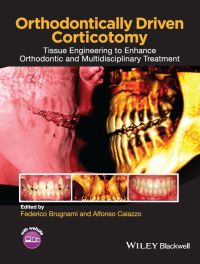 Cover image: Orthodontically Driven Corticotomy 1st edition 9781118486870