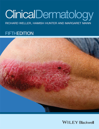 Cover image: Clinical Dermatology, 5th Edition 5th edition 9780470659526