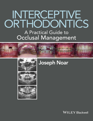 Imagen de portada: Interceptive Orthodontics 1st edition 9780470656211