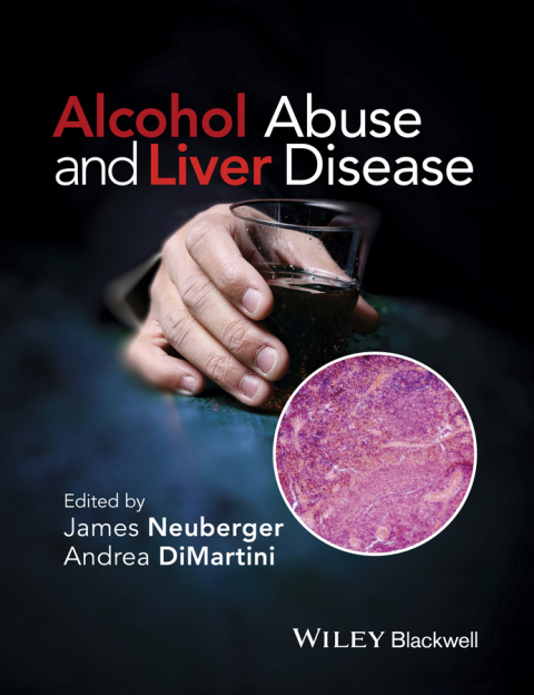 Alcohol Abuse and Liver Disease, 1st Edition - FULL INSTANT DOWNLOAD | PDF DOCX EPUB