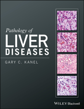 Cover image: Pathology of Liver Diseases 1st edition 9781118895030
