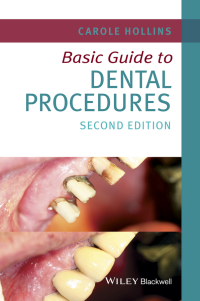 Cover image: Basic Guide to Dental Procedures 2nd edition 9781118924556