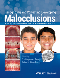 Cover image: Recognizing and Correcting Developing Malocclusions: A Problem-Oriented Approach to Orthodontics 1st edition 9781118886120