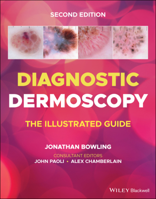 صورة الغلاف: Diagnostic Dermoscopy 2nd edition 9781118930489