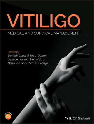 Cover image: Vitiligo: Medical and Surgical Management 1st edition 9781118937419