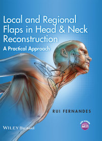 صورة الغلاف: Local and Regional Flaps in Head and Neck Reconstruction 1st edition 9781118340332