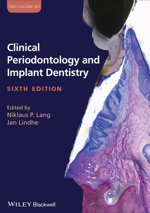 Clinical Periodontology and Implant Dentistry, 6th Edition - FULL INSTANT DOWNLOAD | PDF DOCX EPUB