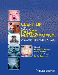 Cover image: Cleft Lip and Palate Management: A Comprehensive Atlas 1st edition 9781118607541