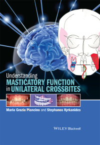 صورة الغلاف: Understanding Masticatory Function in Unilateral Crossbites 1st edition 9781118971871