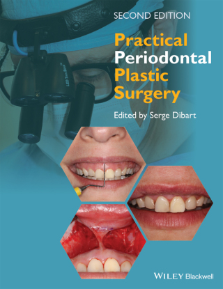 صورة الغلاف: Practical Periodontal Plastic Surgery 2nd edition 9781118360651