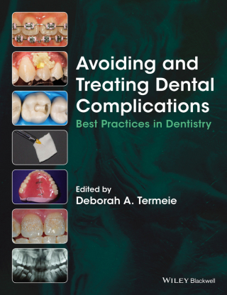 Cover image: Avoiding and Treating Dental Complications 1st edition 9781118988022