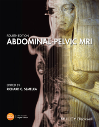 Imagen de portada: Abdominal-Pelvic MRI 4th edition 9781119012931