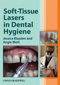 Cover image: Soft-Tissue Lasers in Dental Hygiene 1st edition 9780470958544