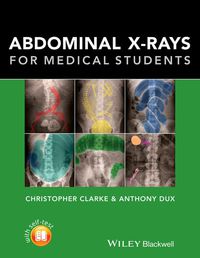 Cover image: Abdominal X-rays for Medical Students 1st edition 9781118600559