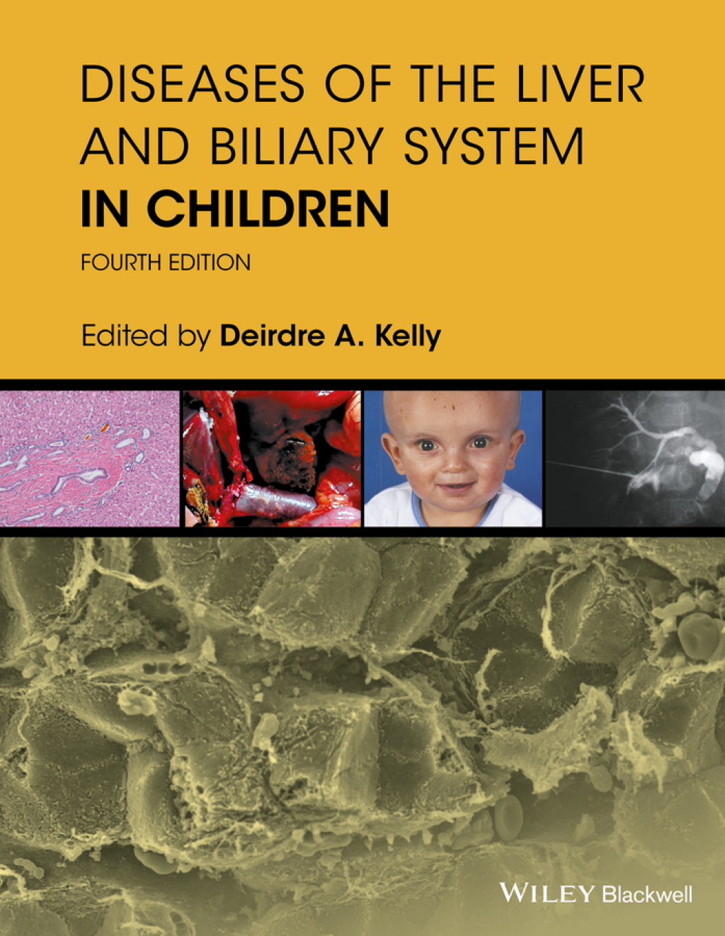 Diseases of the Liver and Biliary System in Children 4th Edition