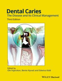 صورة الغلاف: Dental Caries: The Disease and its Clinical Management 3rd edition 9781118935828