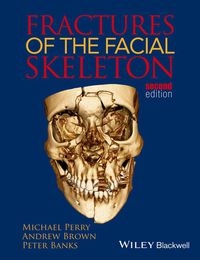Cover image: Fractures of the Facial Skeleton 1st edition 9781119967668
