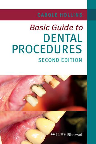 Cover image: Basic Guide to Dental Procedures 2nd edition 9781118924556