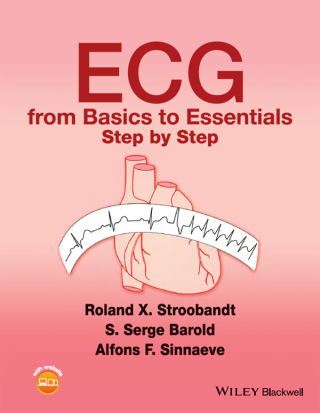 Cover image: ECG from Basics to Essentials: Step by Step 1st edition 9781119066415