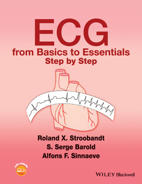 ECG from Basics to Essentials: Step by Step: Step by Step, 1st Edition - FULL INSTANT DOWNLOAD | PDF DOCX EPUB