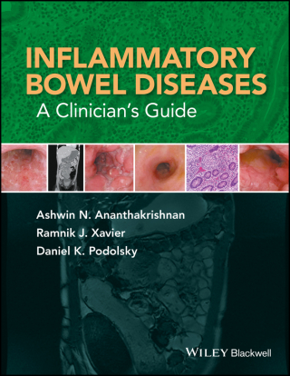 Cover image: Inflammatory Bowel Diseases: A Clinician's Guide 1st edition 9781119077602