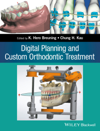 صورة الغلاف: Digital Planning and Custom Orthodontic Treatment 1st edition 9781119087779