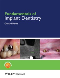 Cover image: Fundamentals of Implant Dentistry 1st edition 9781118274965