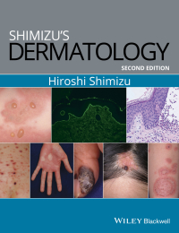 Cover image: Shimizu's Dermatology 2nd edition 9781119099055