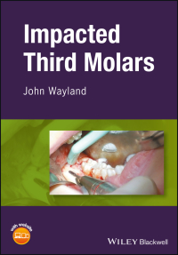 Cover image: Impacted Third Molars 1st edition 9781119118336