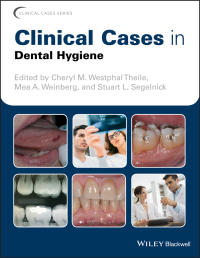 Imagen de portada: Clinical Cases in Dental Hygiene 1st edition 9781119145028