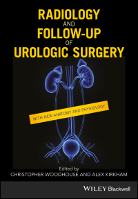 Omslagafbeelding: Radiology and Follow-up of Urologic Surgery 1st edition 9781119162087
