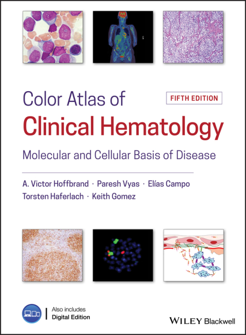 Color Atlas of Clinical Hematology: Molecular and Cellular Basis of Disease, 5th Edition - FULL INSTANT DOWNLOAD | PDF DOCX EPUB