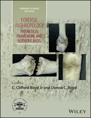Cover image: Forensic Anthropology: Theoretical Framework and Scientific Basis 1st edition 9781119226383
