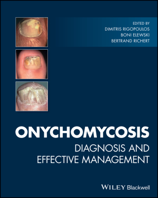 Cover image: Onychomycosis 1st edition 9781119226536