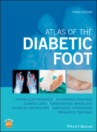 صورة الغلاف: Atlas of the Diabetic Foot 3rd edition 9781119255239