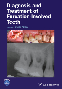 Cover image: Diagnosis and Treatment of Furcation-Involved Teeth 1st edition 9781119270652