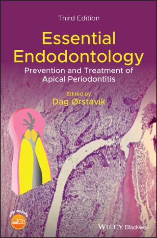 Cover image: Essential Endodontology 3rd edition 9781119271956