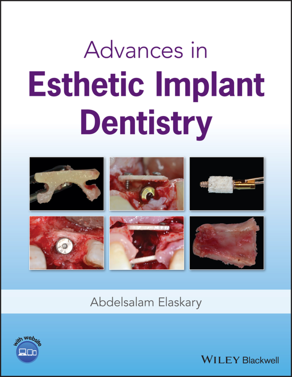 Advances in Esthetic Implant Dentistry 1st Edition