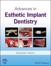 Cover image: Advances in Esthetic Implant Dentistry 1st edition 9781119286677