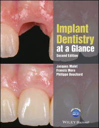 Cover image: Implant Dentistry at a Glance 2nd edition 9781119292609