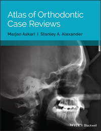Cover image: Atlas of Orthodontic Case Reviews 1st edition 9781119303756