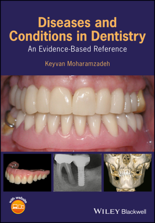 Cover image: Diseases and Conditions in Dentistry 1st edition 9781119312031