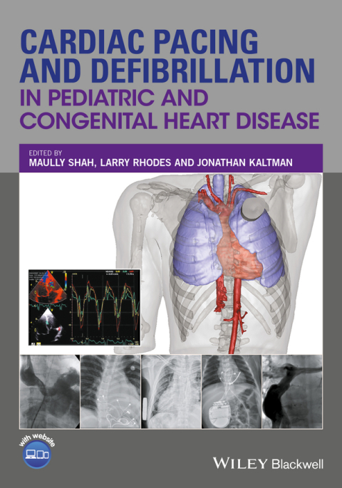 Cardiac Pacing and Defibrillation in Pediatric and Congenital Heart Disease, 1st Edition - FULL INSTANT DOWNLOAD | PDF DOCX EPUB
