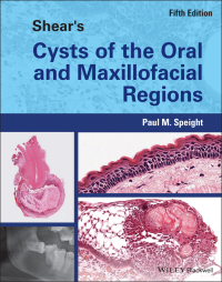 Imagen de portada: Shear's Cysts of the Oral and Maxillofacial Regions 5th edition 9781119354994
