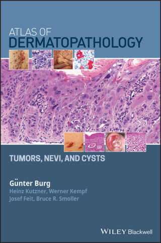 Cover image: Atlas of Dermatopathology: Tumors, Nevi, and Cysts 1st edition 9781119371540