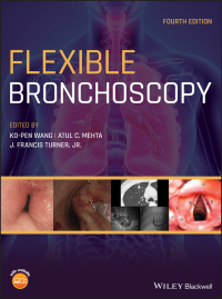 Cover image: Flexible Bronchoscopy 4th edition 9781119389057