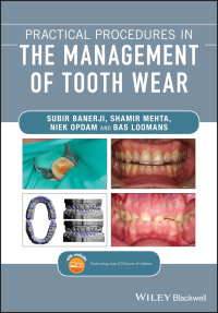 Cover image: Practical Procedures in the Management of Tooth Wear 1st edition 9781119389866