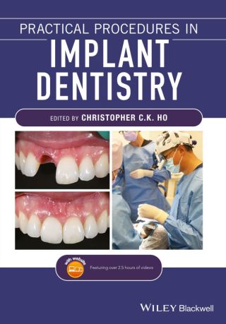 Cover image: Practical Procedures in Implant Dentistry 1st edition 9781119399179