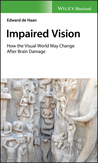 Cover image: Impaired Vision 1st edition 9781119423911