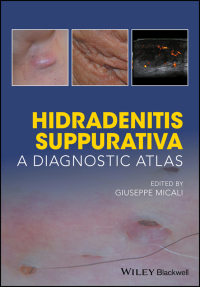 Cover image: Hidradenitis Suppurativa 1st edition 9781119272953